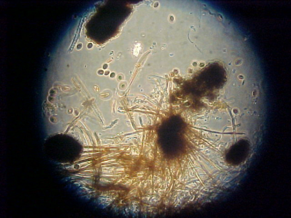 Chaetomium mold